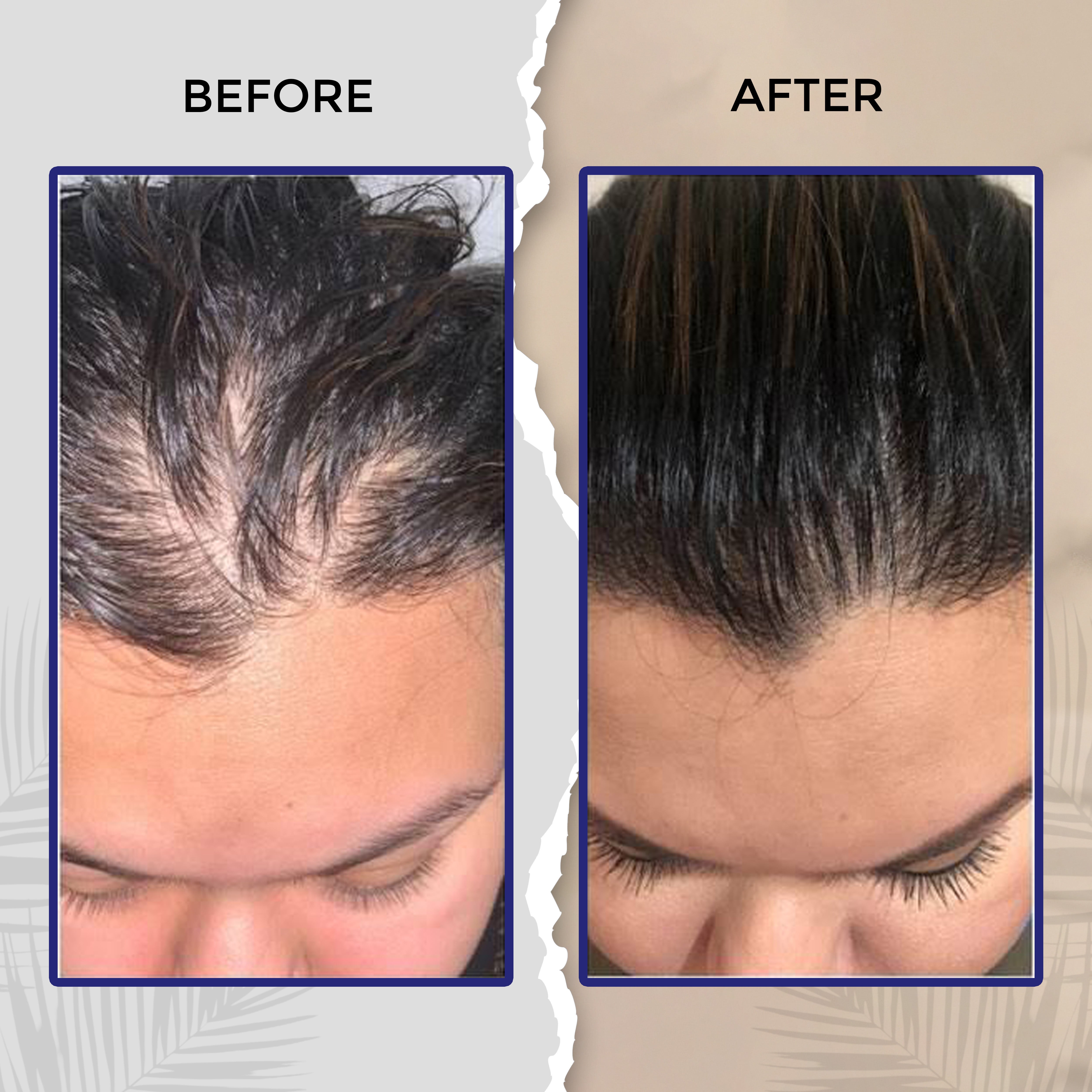 Herbal Hair Wash Powder – KeshSutra for Hair Growth & Dandruff