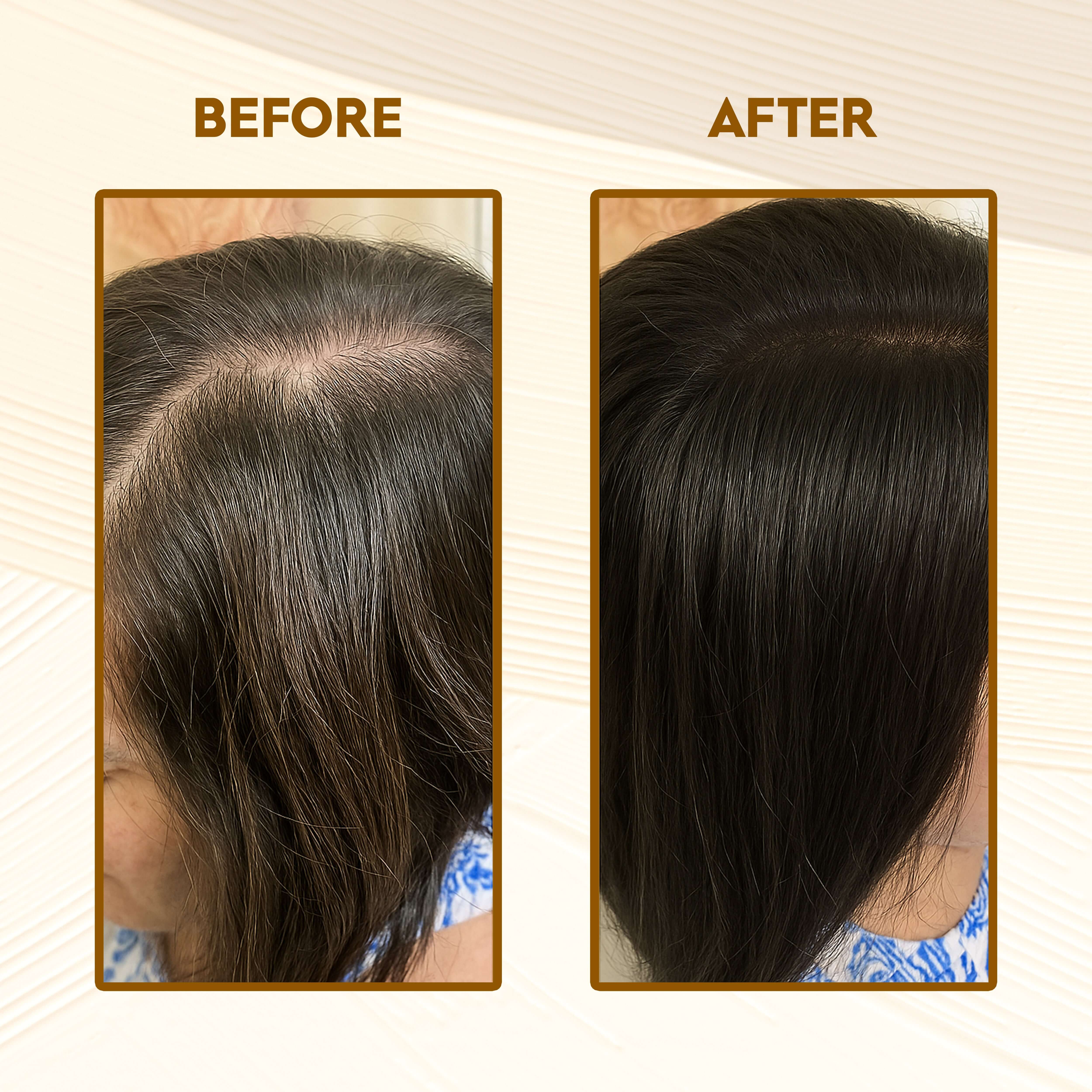 Before and after results using Triple Vitality Hair Mix of Amla, Reetha, and Shikakai, showing improved hair thickness and shine.