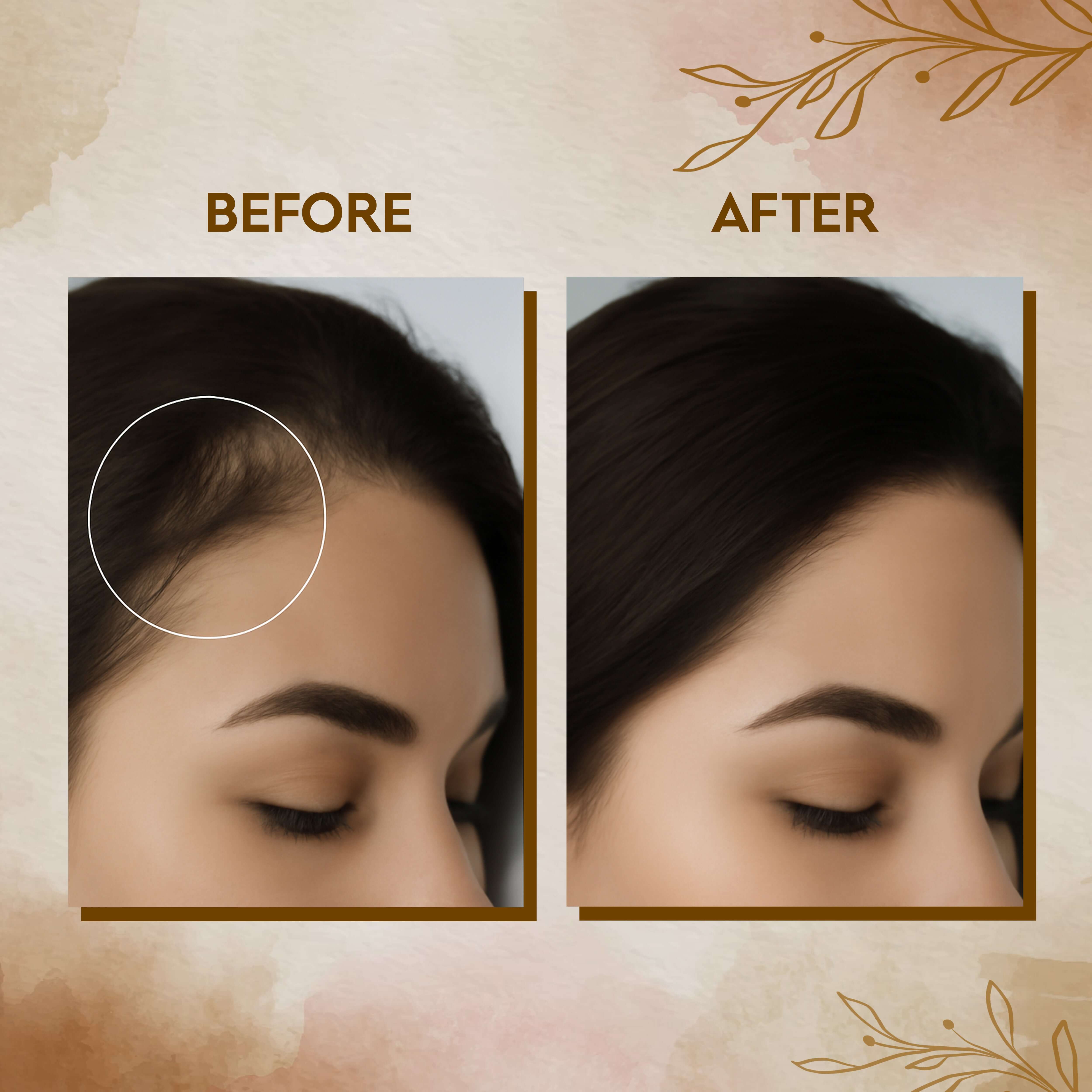 Comparison of hair before and after using Ayurvedic Bhringraj Powder, showing improved thickness and hair growth.