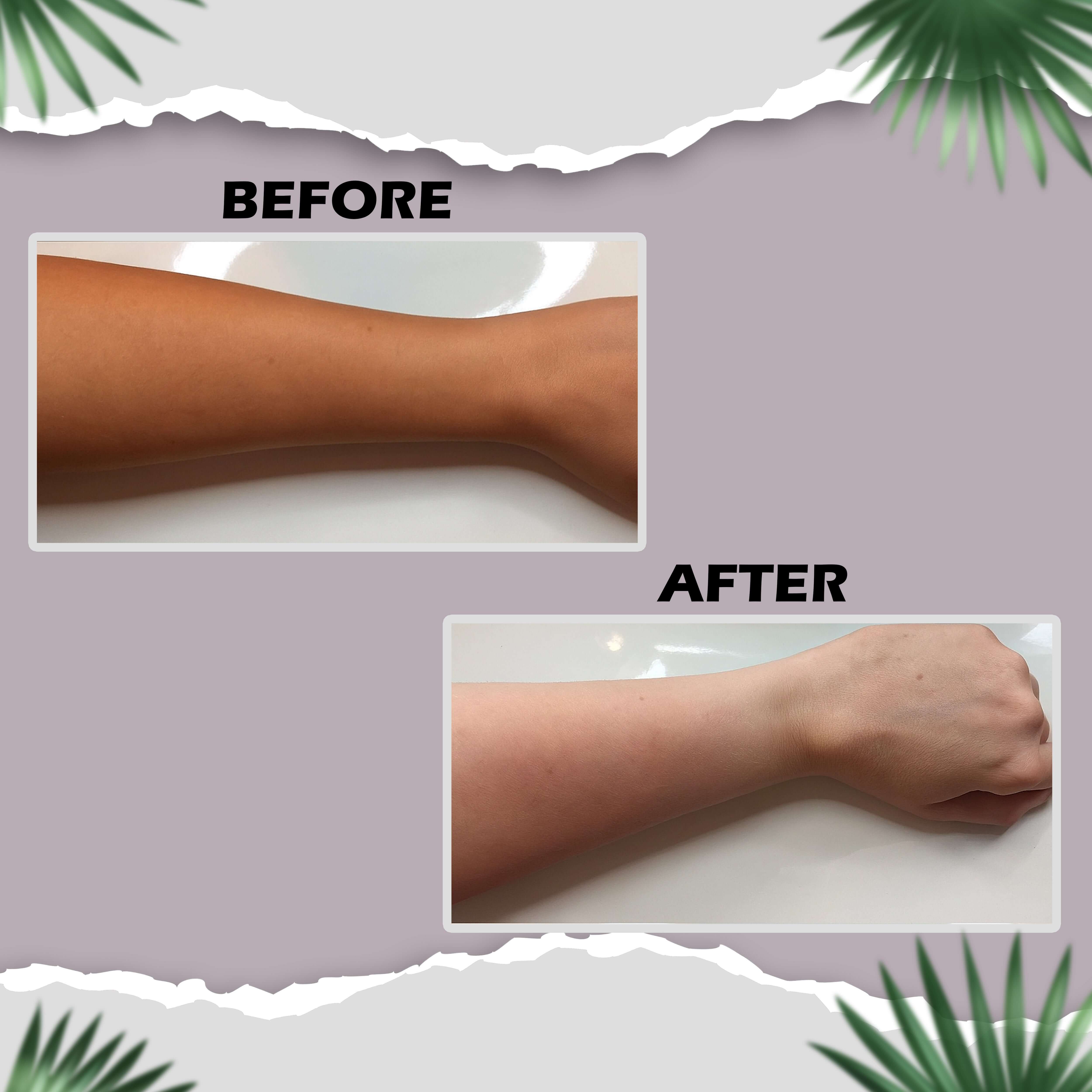 Before and after using AyuRaksha Antibacterial Bath Powder showing skin tone improvement.