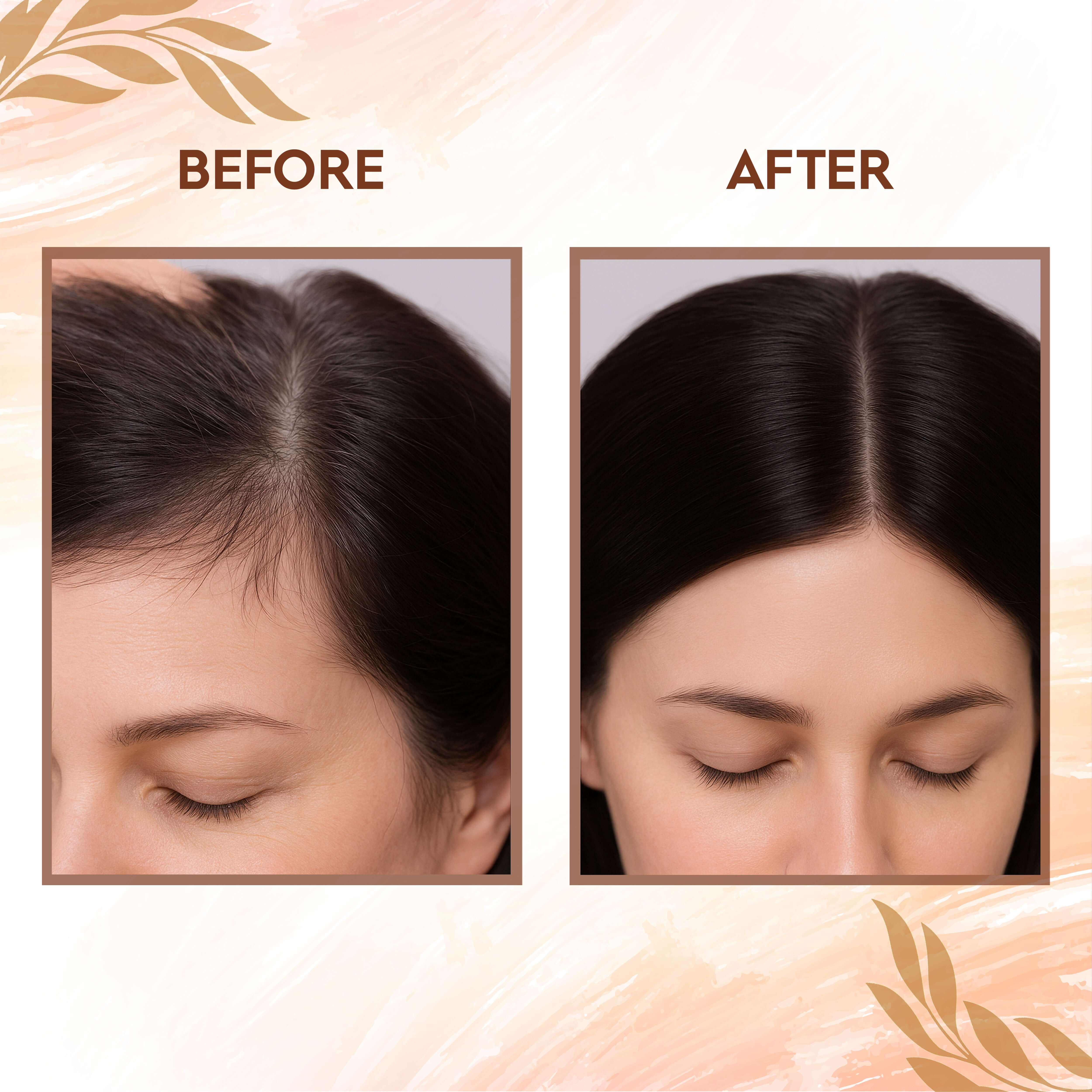 Before and after results of using Amla, Reetha, Shikakai for hair growth and shine.