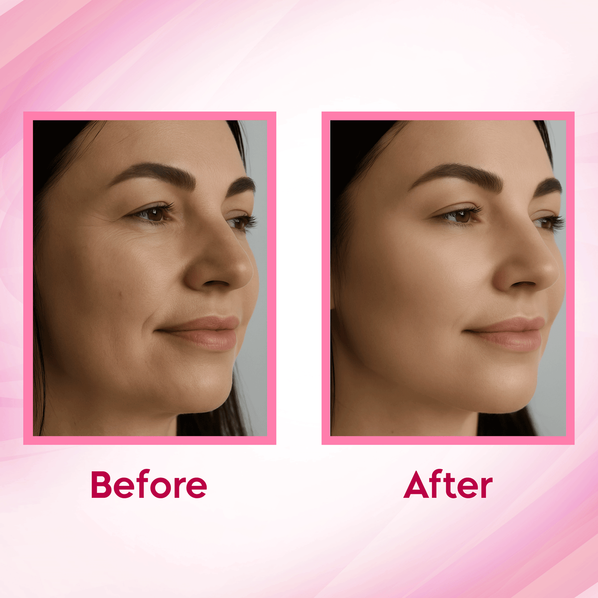 Before and after using Rose & Hibiscus Powder Combo for glowing, hydrated skin by Aayogi Ayurveda.
