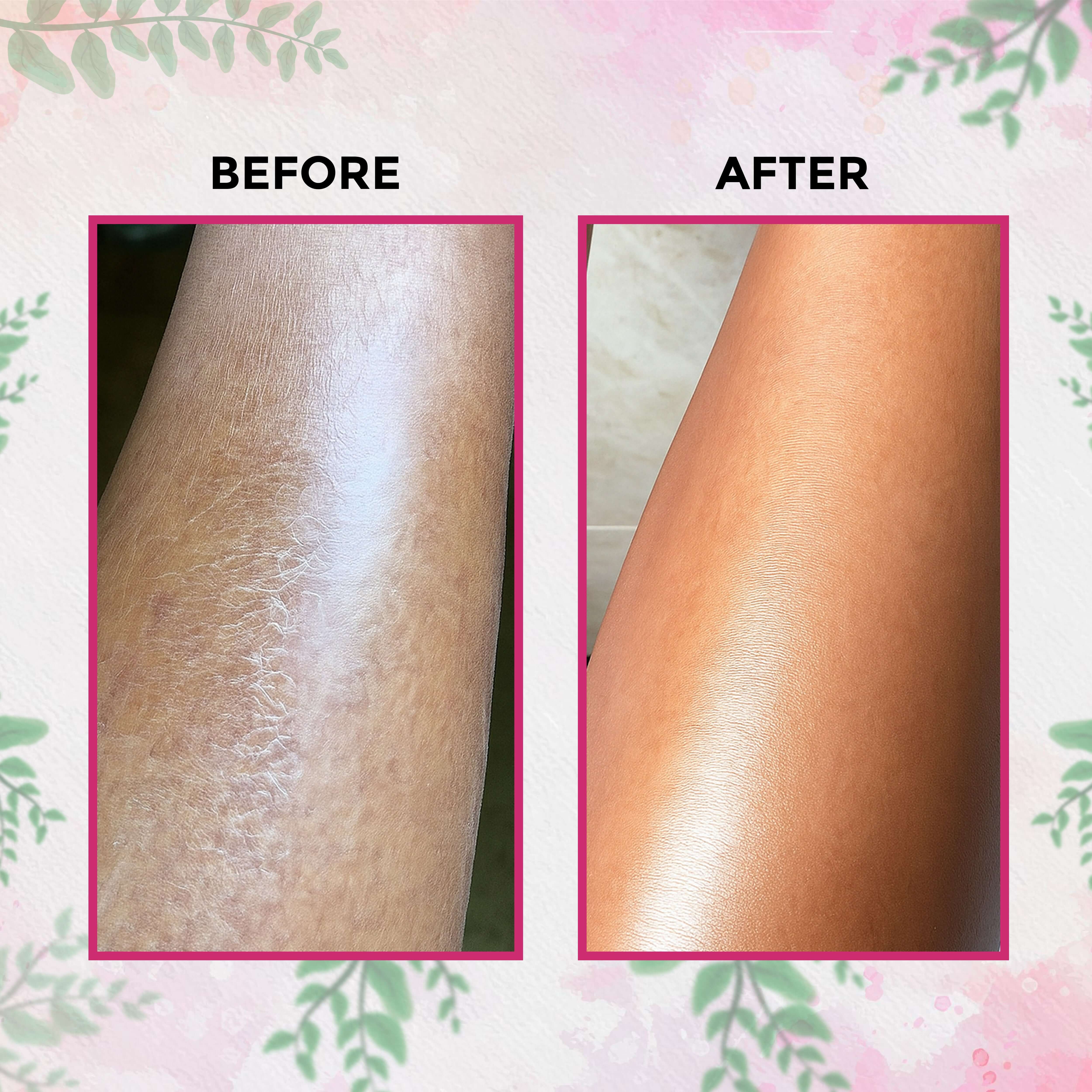Comparison of skin before and after using RasaGlow Herbal Bathing Powder, showing nourished and brightened results.