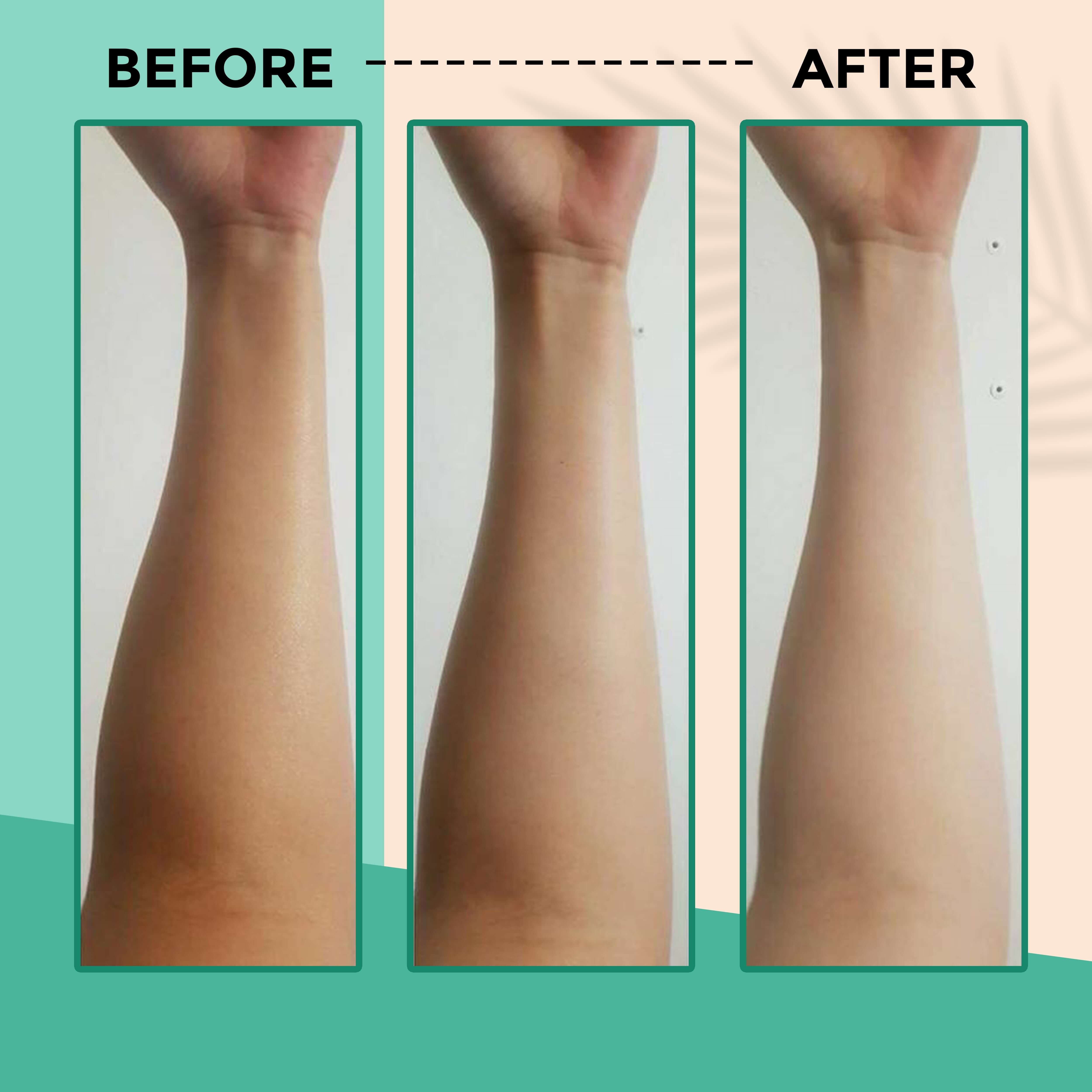 Comparison of arm skin tone before and after using KantiKaya Face Brightening Pack for glowing, even skin tone.
