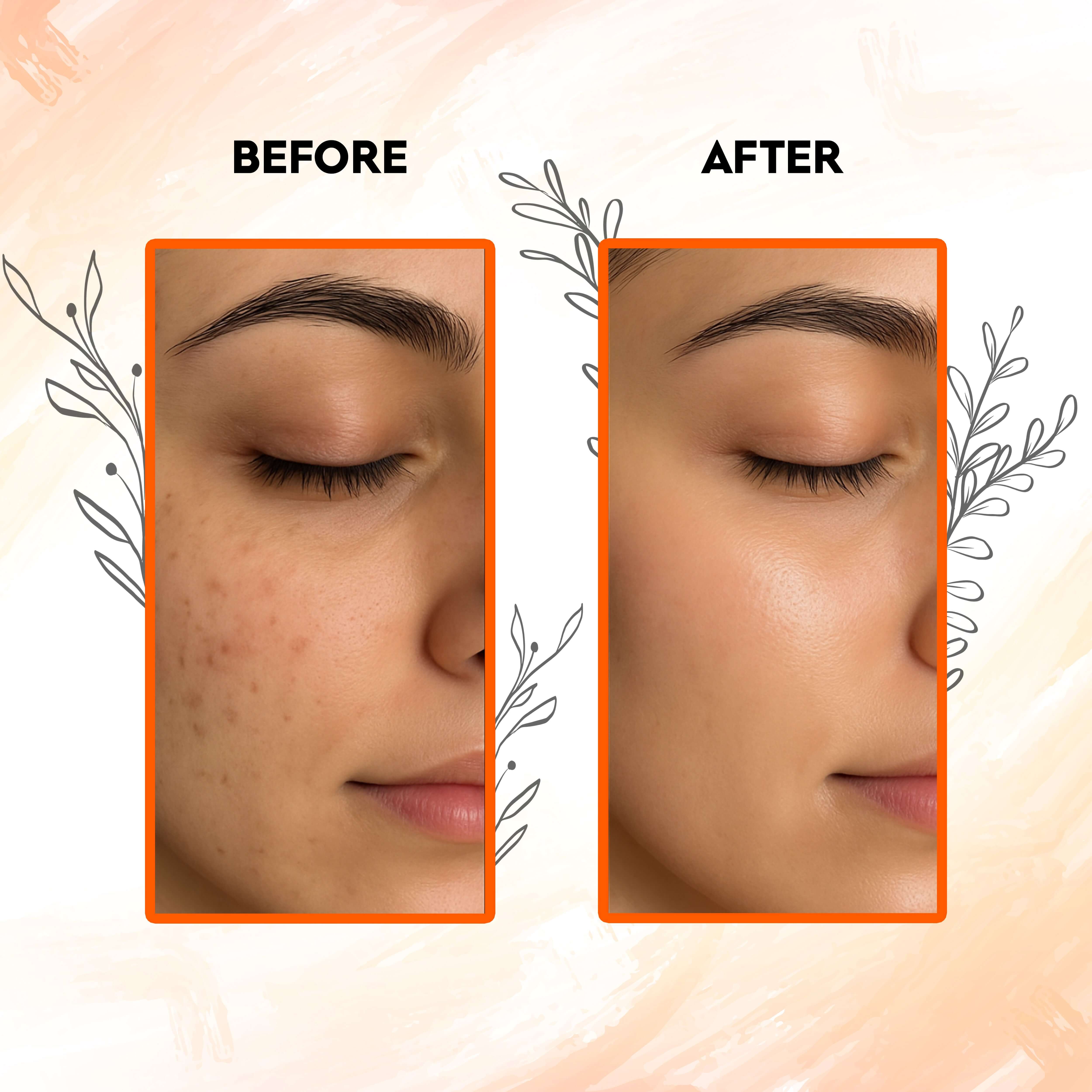 Before and after results of using Glow Boost Orange Peel Powder for clear and radiant skin.