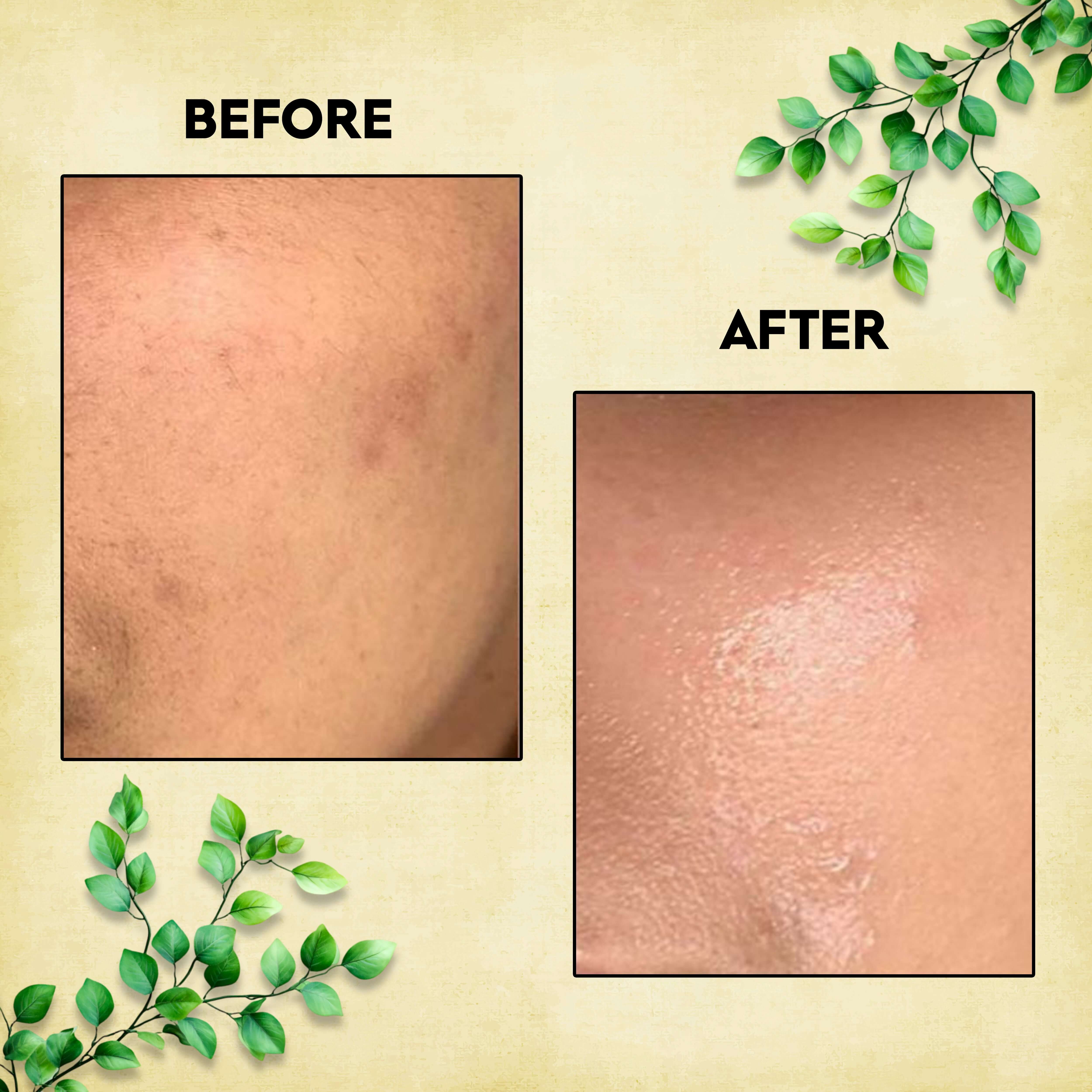 Before and after image showing skin improvement using GrainGlow Rice Ubtan Powder, with visible brightening and smoothing effects.