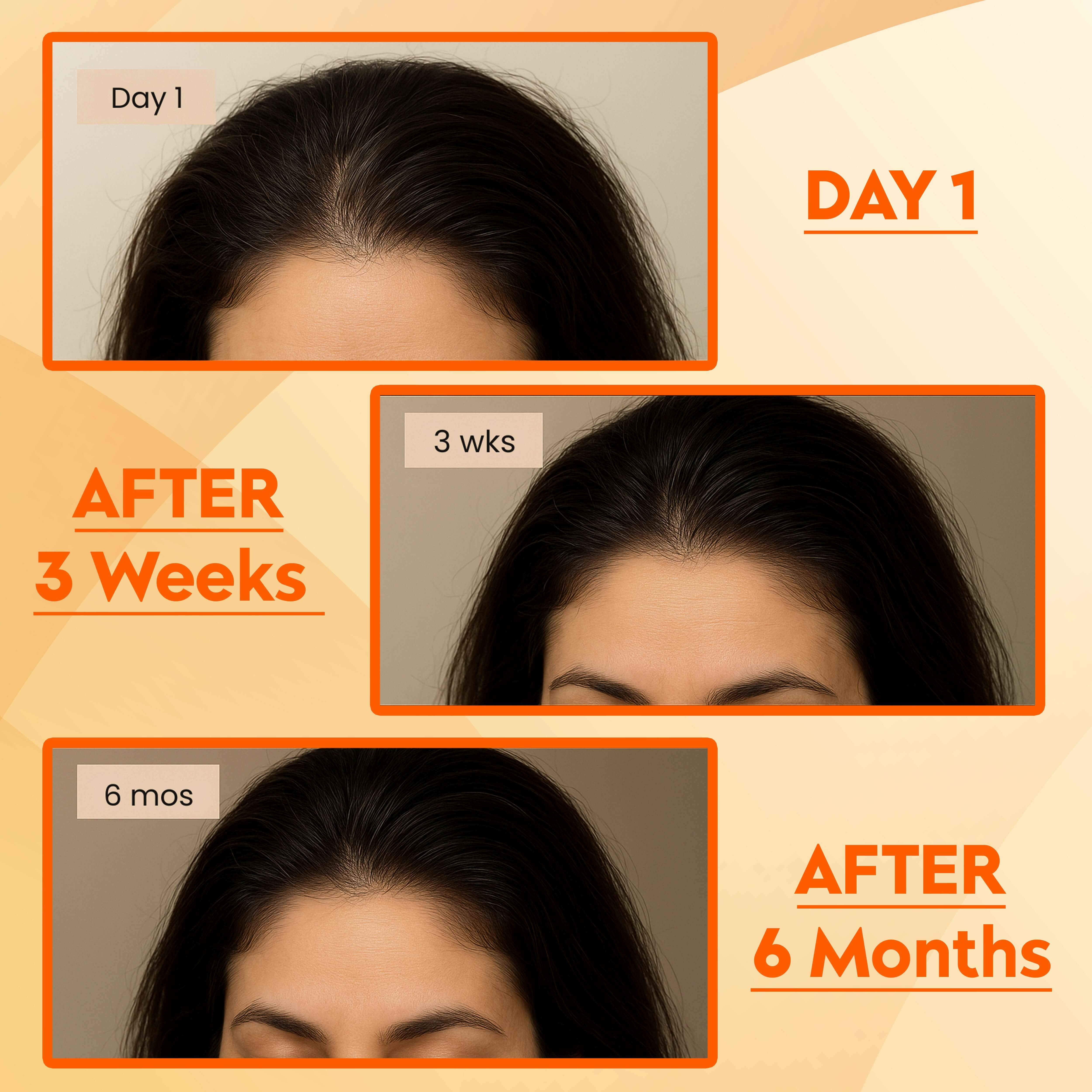 Hair growth progress over time using Reetha Powder for Healthy Hair, showing before and after results at day 1, 3 weeks, and 6 months.