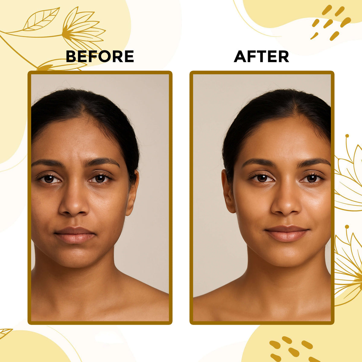 Before and after image showing skin transformation using TvaritaGlow Ayurvedic Ubtan by Aayogi Ayurveda for radiance and glow.