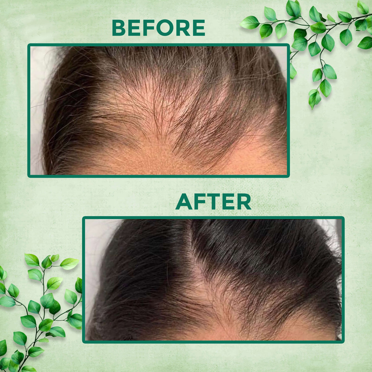 Before and after image showing improved hair health using Keshamrit Herbal Hair Wash Powder from Aayogi Ayurveda.