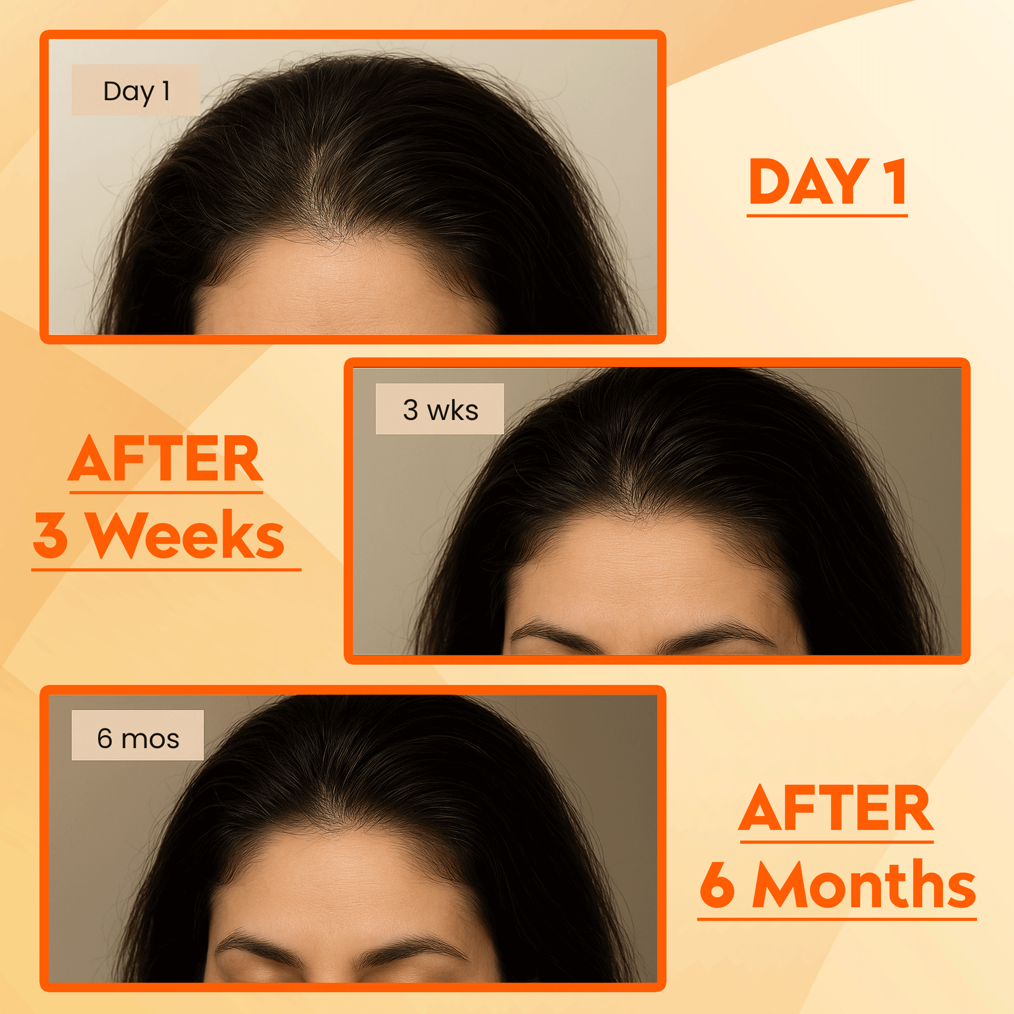 Hair growth progress over 6 months with Reetha Herbal Hair Cleanser; Day 1, 3 weeks, 6 months improvement shown.