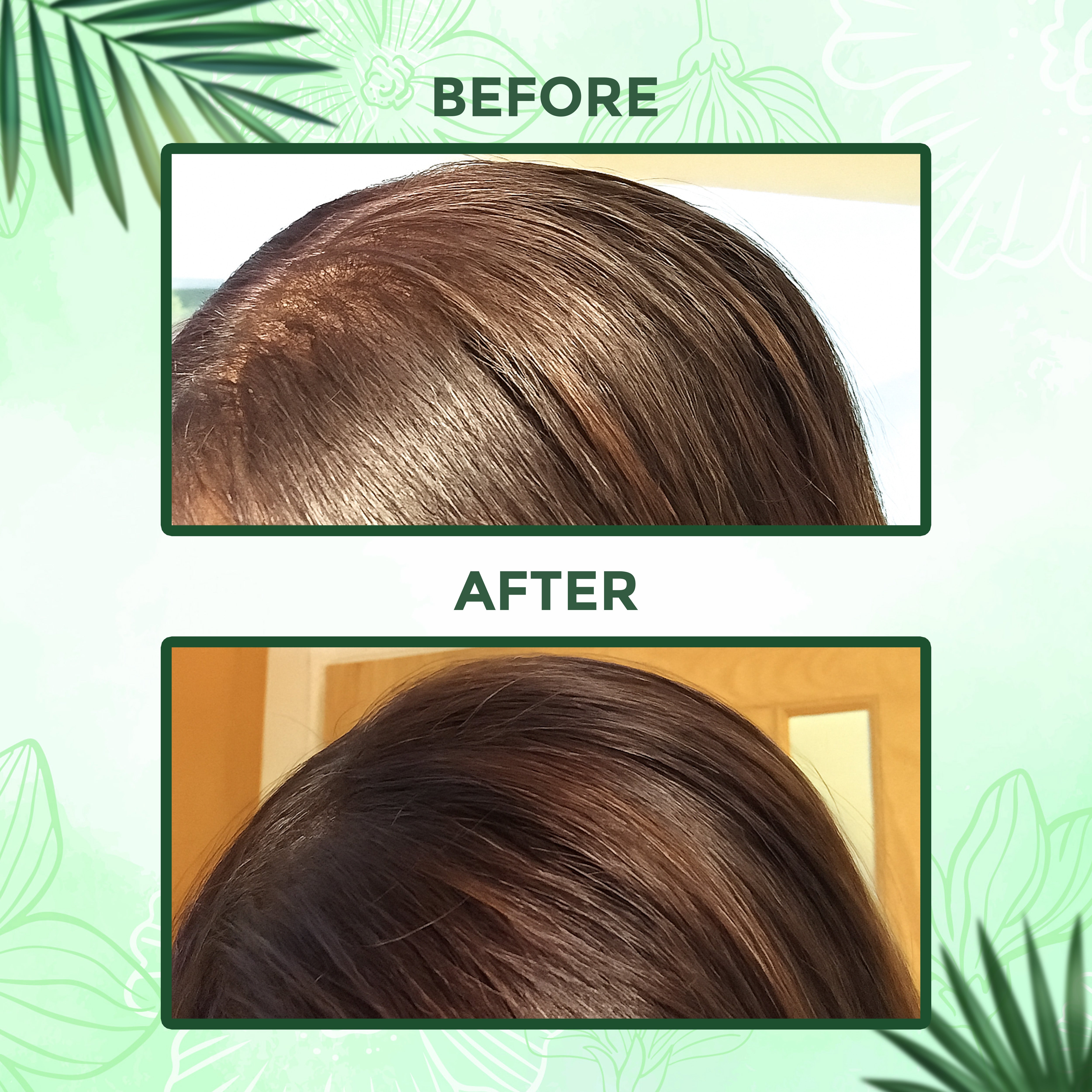 Before and after results using TriDosh Herbal Hair Wash Shampoo Powder, showcasing healthier and shinier hair.